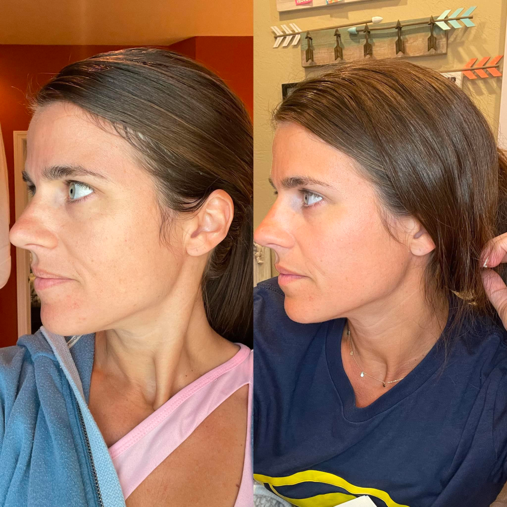 Megan Blinka, Maegan Blinka, HFF, Herbal face foods, Herbal face foods results, organic skin care line, the #1 anti aging skin care line, how to reduce melasma, how to reduce sun spots, how to reduce the signs of aging, organic skin care line, a botox alternative to wrinkle reducing, how to reverse extreme sun damage on your skin, how to cure acne, how to rid the signs of acne scarring, how to get rid of dark circles, how to reduce under eye circles, does HFF work, does herbal face foods actually work, is herbal face foods worth it, why is herbal face foods so expensive